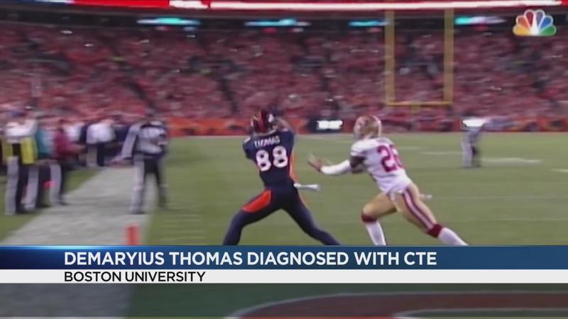 Late NFL star diagnosed with CTE 